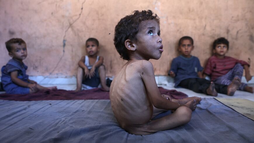 'We are now witnessing a deadly surge in malnutrition-related deaths,' said Tedros