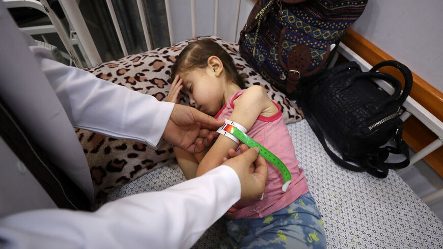 A doctor checks Palestinian girl Jana Ayad, who is malnourished, according to medics, as she receives treatment at a hospital in Gaza City, amid a worsening hunger crisis, July 29, 2025. REUTERS/Mahmoud Issa