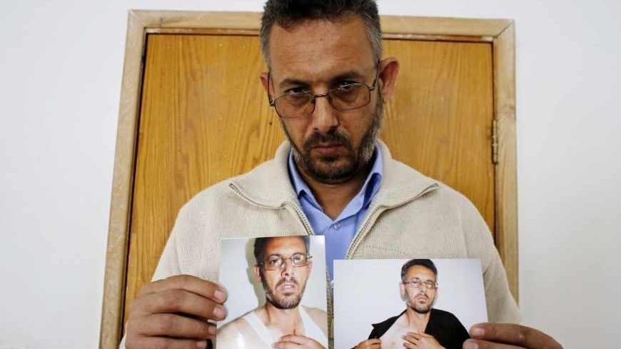 Mohammed Ghannam shows photographs depicting what he says are injuries sustained when he was detained by Palestinian security forces, at his home in the West Bank village of Dura, near Hebron May 12, 2013. Ghannam, 44, said plainclothes security forces from the Palestinian Authority (PA) detained him last month for belonging to Hamas and beat him mute. Led by the secular Fatah party, the PA has pursued surveillance, firings, arrests and torture to bar its Islamist militant rivals Hamas from public life in t