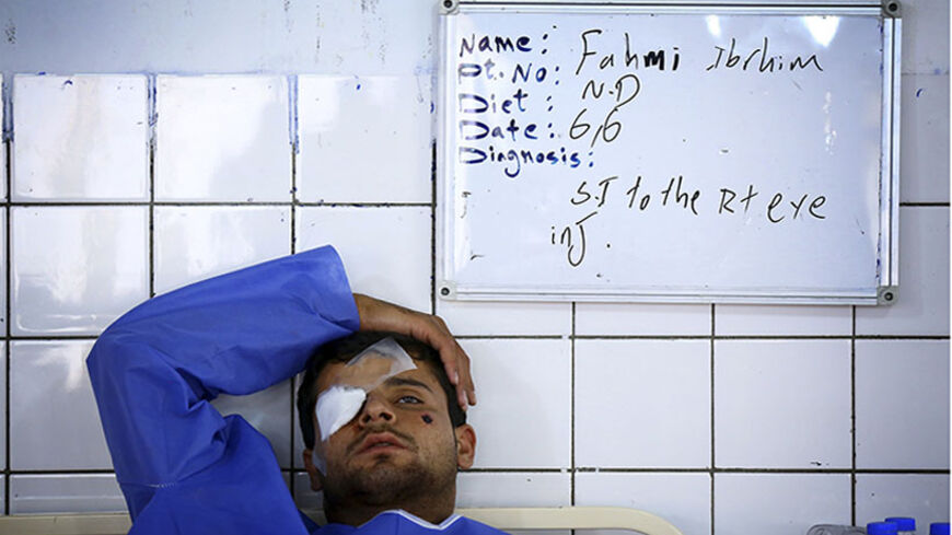 A man, who was injured during a suicide bomber attack in Mwafaqiya village at Mosul, lies in a hospital bed after he was brought for treatment in a hospital in Arbil, the capital of the autonomous Kurdistan region, June 6, 2014.  Militants fought Iraqi security forces in the northern city of Mosul on Friday, a day after parts of another city were briefly overrun by insurgents. A curfew was imposed on Mosul on Thursday, when Sunni Islamist insurgents moved into parts of the city of Samarra, bringing them wit