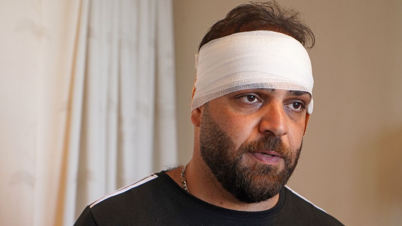 An injured man is pictured at a hospital after shelling in the city of Zakho in the north of Iraq's autonomous Kurdish region on July 20