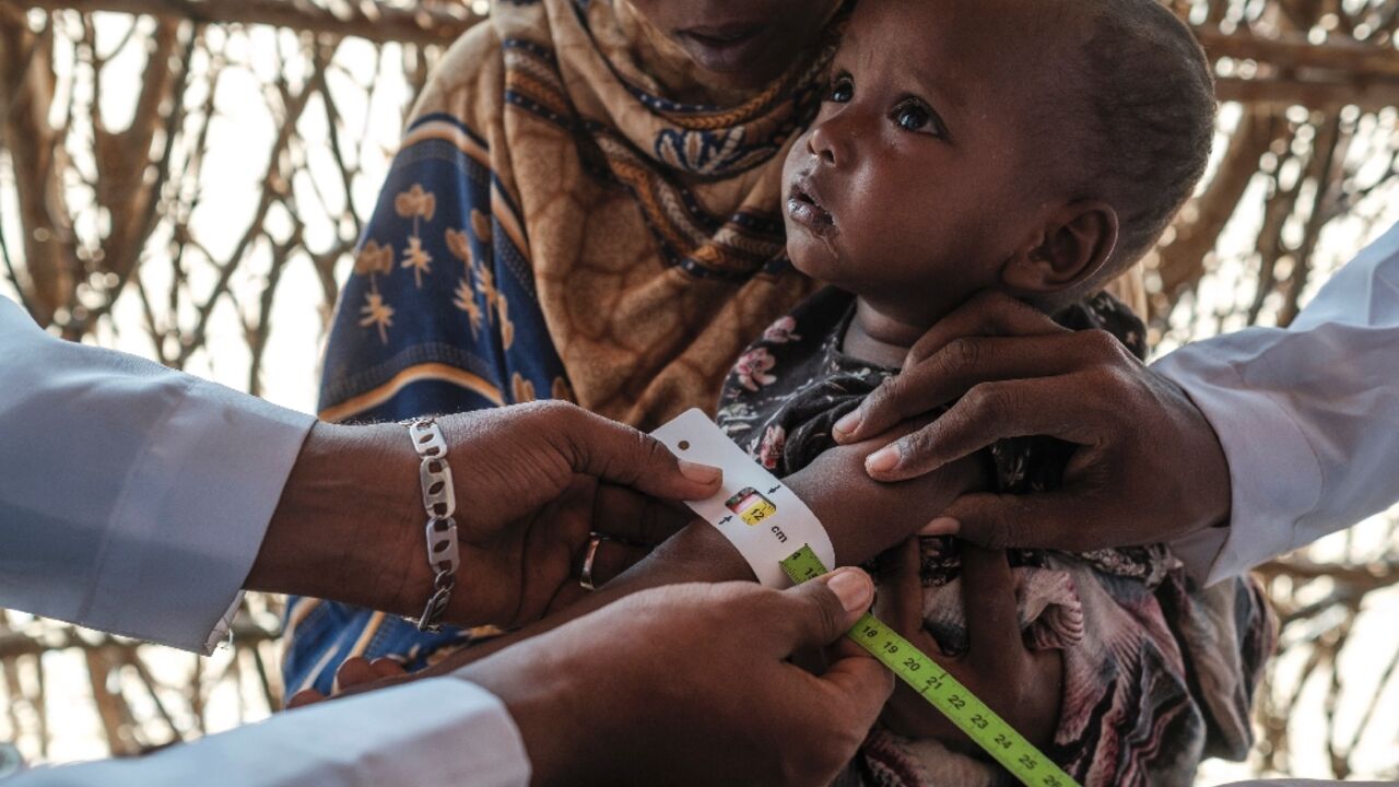 A health worker takes an arm measurement, a benchmark of malnutrition, at a Save the Children mobile clinic near Gode, Ethiopia A health worker takes an arm measurement, a benchmark of malnutrition, at a Save the Children mobile clinic near Gode, Ethiopia
