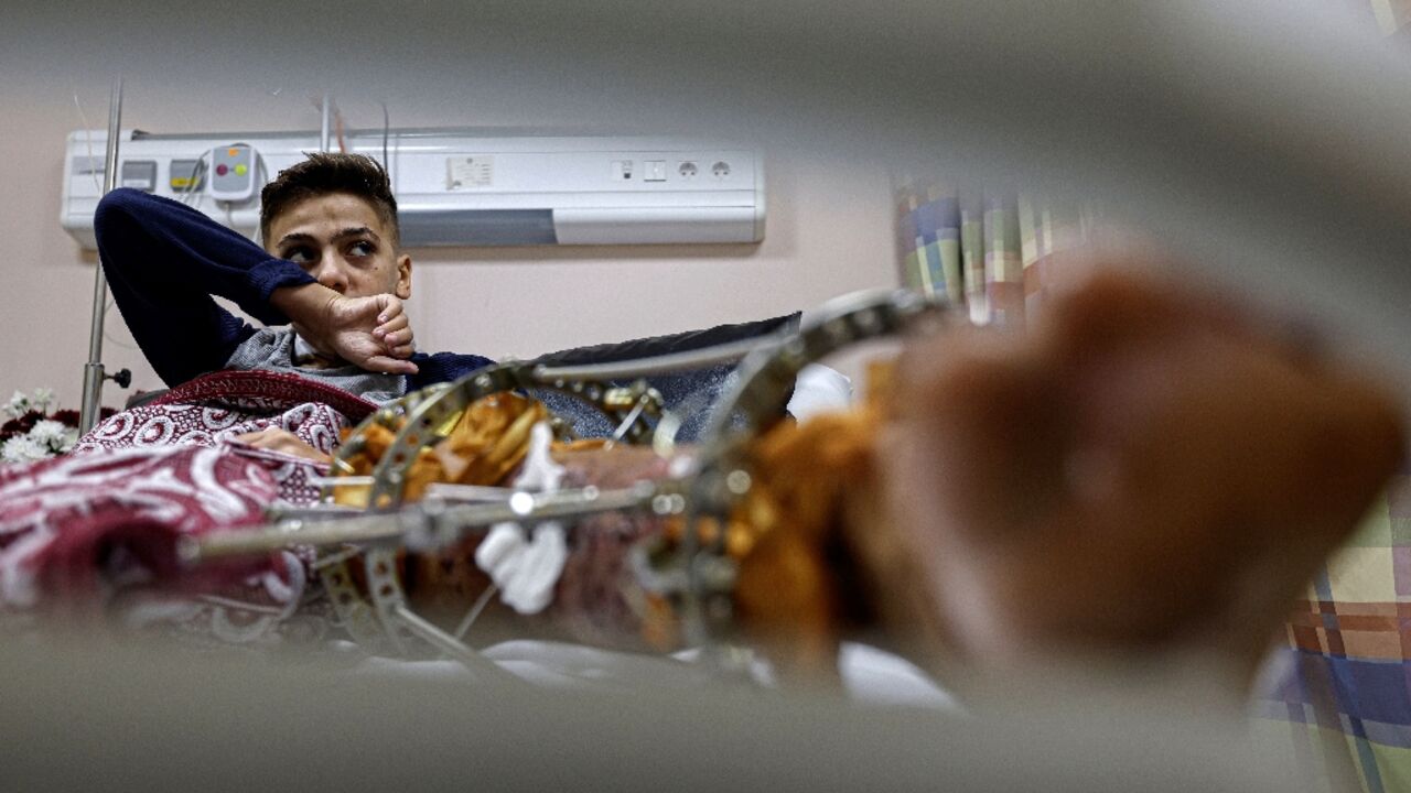 Palestinian boy Youssef, 13, from Gaza receives medical care at Nasser hospital in Cairo Palestinian boy Youssef, 13, from Gaza receives medical care at Nasser hospital in Cairo