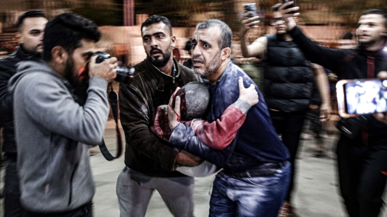 A man carrying a child, wounded in an Israeli bombardment, arrives to Nasser hospital in Khan Yunis in the southern Gaza Strip on December 17, 2023