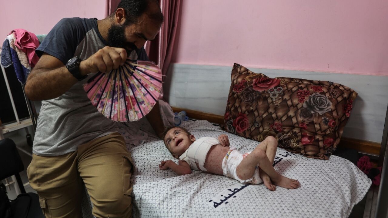 According to the World Health Organization more than 12
50,000 people have contracted skin diseases in the war-devastated Gaza Strip According to the World Health Organization more than 12
50,000 people have contracted skin diseases in the war-devastated Gaza Strip
