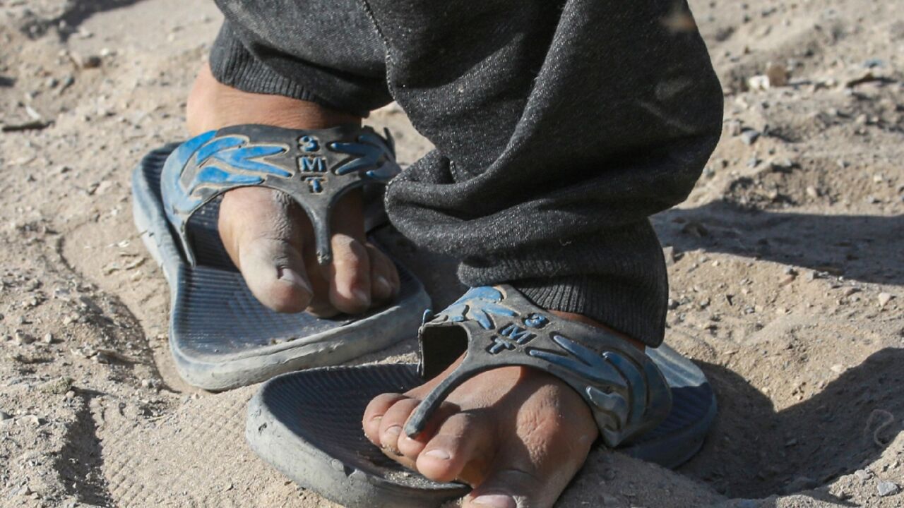 A Palestinian shows his worn-out shoes in Khan Yunis in the southern Gaza Strip