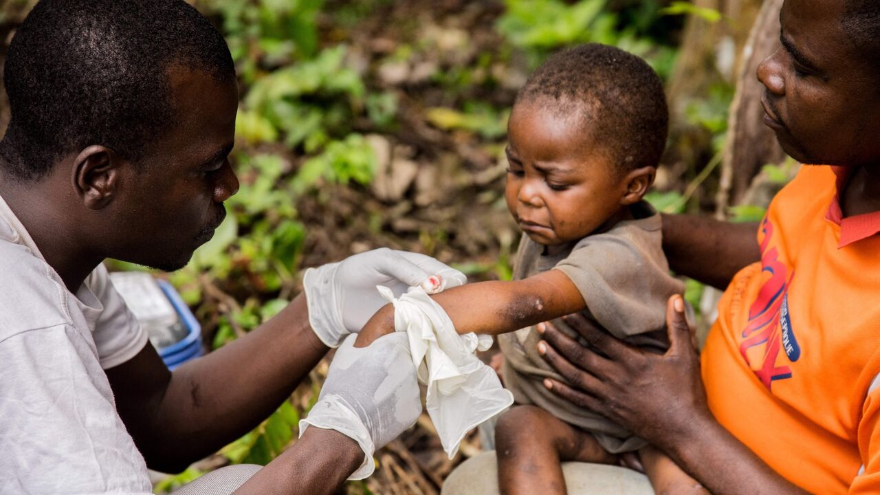 A child affected by monkeypox sits on his father's legs while receiving treatment in the Central African Republic on October 18, 2018.