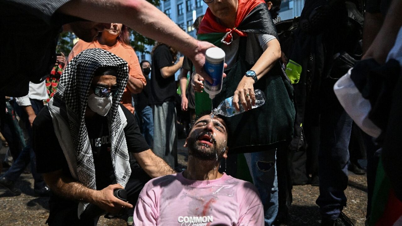 A protester is helped after police deployed pepper spray to disperse demonstrators taking part in a Pro-Palestinian rally against Israeli President Isaac Herzog's visit to Australia in Sydney on February 9, 2026
