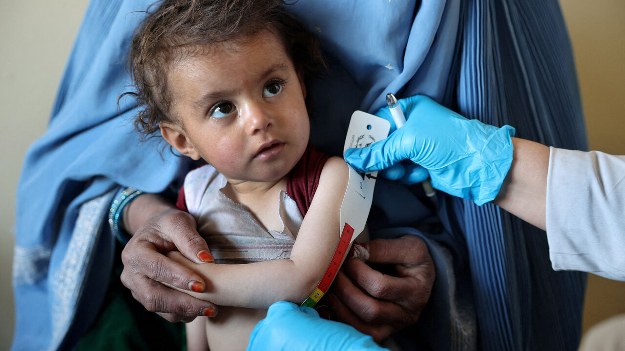 An Afghan girl looks at the doctor as he measures her upper arm at the WFP-supported Qasaba Clinic, after an increase in malnutrition cases following the return of deported Afghans, in Kabul, Afghanistan, January 7, 2026. REUTERS/Sayed Hassib