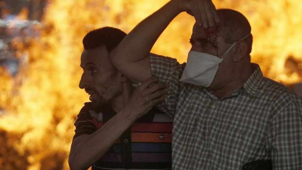 A protester supporting ousted Egyptian President Mohamed Mursi carries an injured demonstrator during clashes outside Azbkya police station at Ramses Square in Cairo A protester supporting ousted Egyptian President Mohamed Mursi carries an injured demonstrator (R) during clashes outside Azbkya police station at Ramses Square in Cairo, August 16, 2013. About 50 people were killed in protests in Cairo on Friday, security officials said. Thousands of supporters of deposed President Mohamed Mursi have been staging nationwide protests against a security crackdown on Islamists. REUTERS/Amr Abdallah Dalsh (EGYPT - Tags: POLITICS CIVIL UNREST TPX IMAGES OF THE DAY) - RTX12NQA