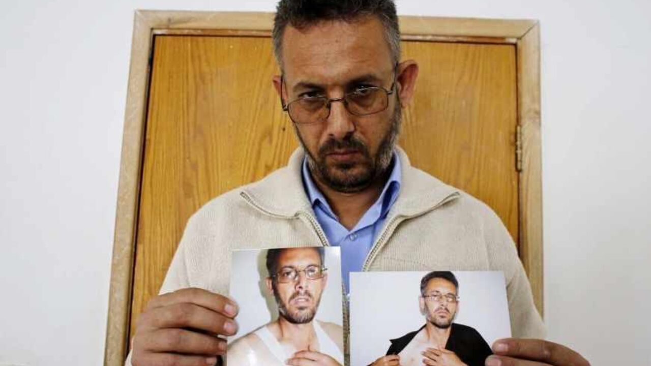 PALESTINIANS-HAMAS/CRACKDOWN Mohammed Ghannam shows photographs depicting what he says are injuries sustained when he was detained by Palestinian security forces, at his home in the West Bank village of Dura, near Hebron May 12, 2013. Ghannam, 44, said plainclothes security forces from the Palestinian Authority (PA) detained him last month for belonging to Hamas and beat him mute. Led by the secular Fatah party, the PA has pursued surveillance, firings, arrests and torture to bar its Islamist militant rivals Hamas from public life in t