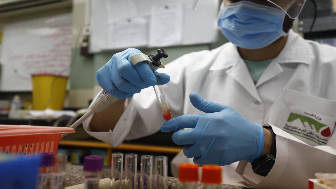 1227908625 An Egyptian medical worker checks the blood of a man who recovered from Covid-19 at the National Blood Transfusion centre in Cairo on July 22, 2020. (Photo by Khaled DESOUKI / AFP) (Photo by KHALED DESOUKI/AFP via Getty Images)
