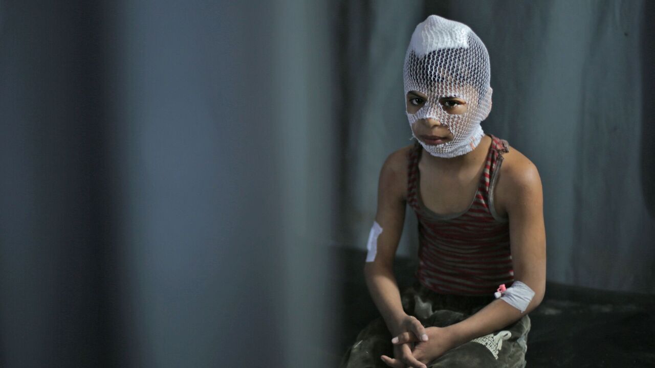1205265243 TOPSHOT - EDITORS NOTE: Graphic content / A wounded Syrian child sits at a makeshift clinic in the town of Maaret Misrin following Syrian government forces airstrikes on March 5, 2020 in the country's northwestern Idlib province. - Russian air strikes killed at least 15 civilians including a child in the last major opposition bastion of Idlib in northwestern Syria, a Britain-based war monitor said. (Photo by Aref TAMMAWI / AFP) (Photo by AREF TAMMAWI/AFP via Getty Images)