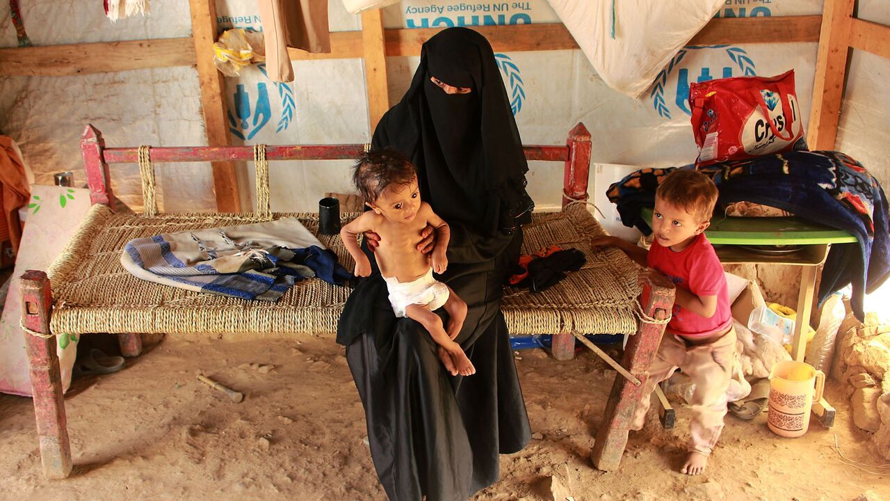 1228324845 Hashem Mahmoud Atin, a ten-month-old displaced Yemeni child suffering from acute malnutrition and who is unable to reach a hospital for treatment, is held by his mother at a camp in Abs in northern Yemen's Hajjah province on September 3, 2020. - Hundreds of children and pregnant women have been negatively affected by the closure of medical clinics funded by the United Nations Children's Fund (UNICEF) in Yemen's displaced camps. (Photo by ESSA AHMED / AFP) (Photo by ESSA AHMED/AFP via Getty Images)