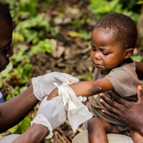 A child affected by monkeypox sits on his father's legs while receiving treatment in the Central African Republic on October 18, 2018.