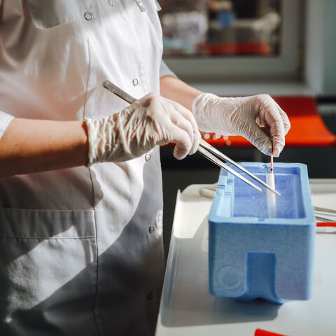 In this stock image, a female embryologist demonstrates freezing straws with embryos and sperm in real IVF laboratory. 