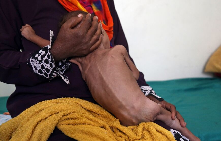 A Yemeni woman holds a child suffering from malnutrition in a hospital in Taez in the country's southwest, in this file photo from November 21, 2018 