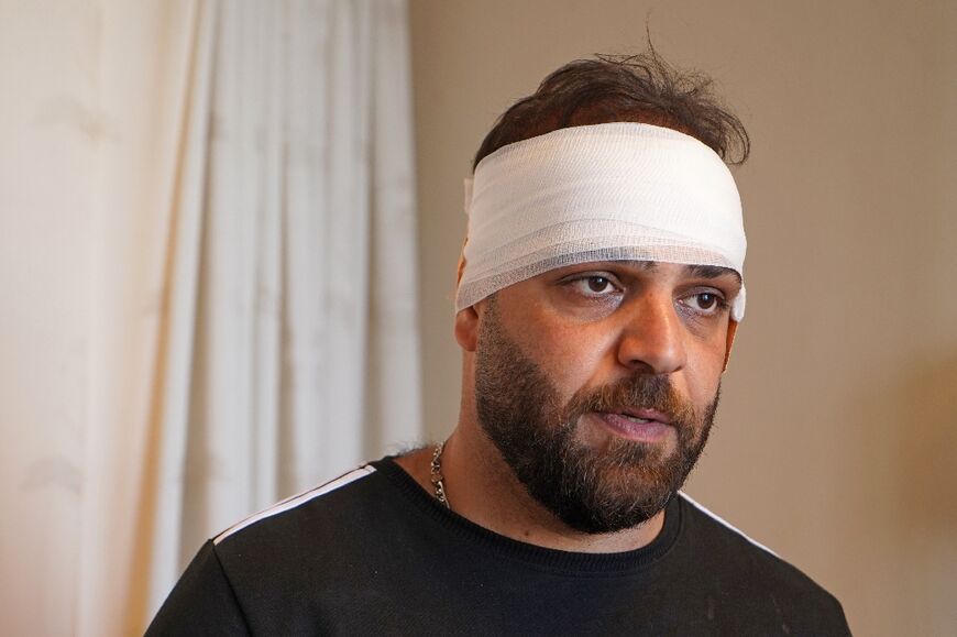 An injured man is pictured at a hospital after shelling in the city of Zakho in the north of Iraq's autonomous Kurdish region on July 20