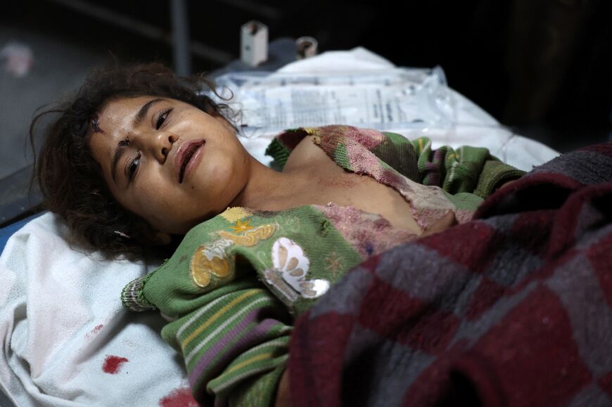 An injured child receives treament at the hospital run by the Syrian American Medical Society (SAMS)