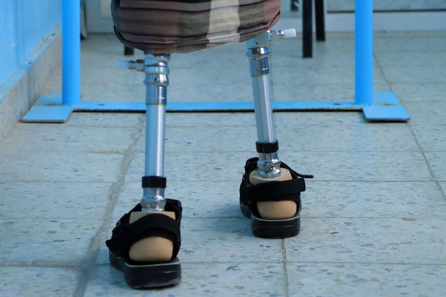 A Yemeni patient does rehabilitation exercises at the prosthetic limb clinic in the King Salman Humanitarian Aid & Relief Centre in Marib