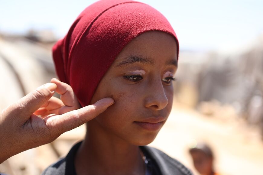 A medic inspects a young woman with for a skin complication at a displacement camp