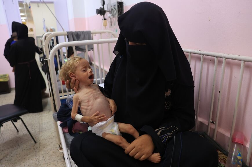 Eleven-month-old Palestinian girl Sham Qadeeh, suffering from malnutrition, is nursed by her mother Basma Qudayeh at the Nasser hospital in Khan Yunis, in the southern Gaza Strip on July 10, 2024