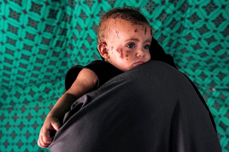 A Palestinian baby girl whose parents and siblings were reportedly killed in Israeli bombardment is carried by her aunt in Khan Yunis in the Gaza Strip