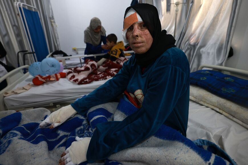 Palestinian Nisrine al-Najar receives treatment at a clinic set up by Doctors Without Border (MSF) in Rafah, in March
 Medical facilities have in the past weeks reported increasing numbers of burn victims. According to Muhammad al-Mughayyir, of Gaza's civil defence agency, Israeli forces have been using "new weapons that cause increased ignition and burning".