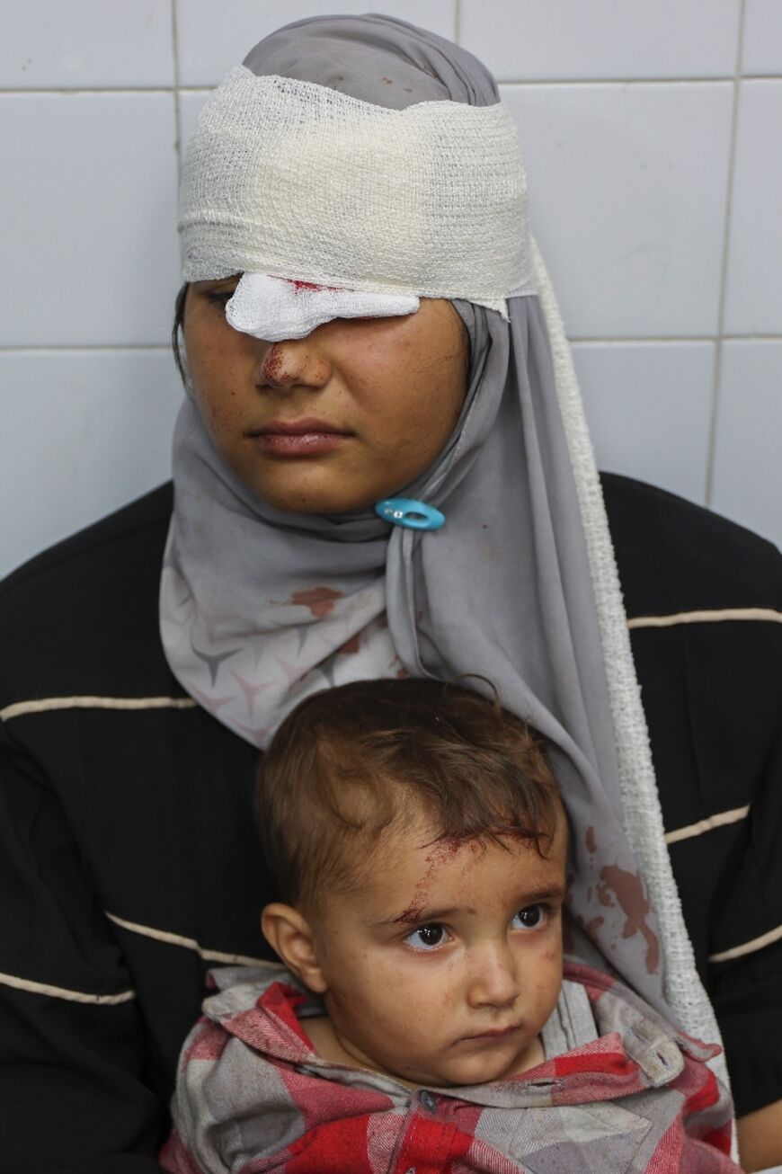 A woman and her child who were injured during an Israeli military operation at Gaza's Jabalia refugee camp