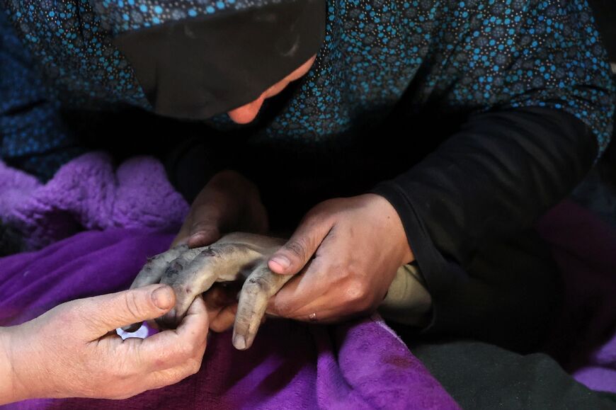 On New Year's Day, Palestinian women at Al-Ahli Arab Hospital in Gaza City mourn holding the hand of a relative killed in an Israeli strike 