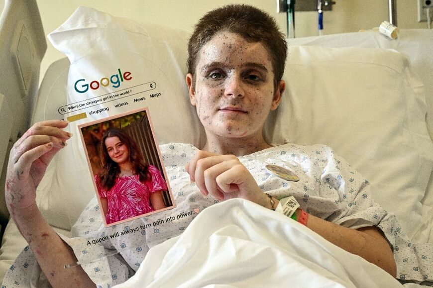 Bazzi's daughter Aseel shows a portrait of herself taken before she was gravely wounded in the Israeli strike